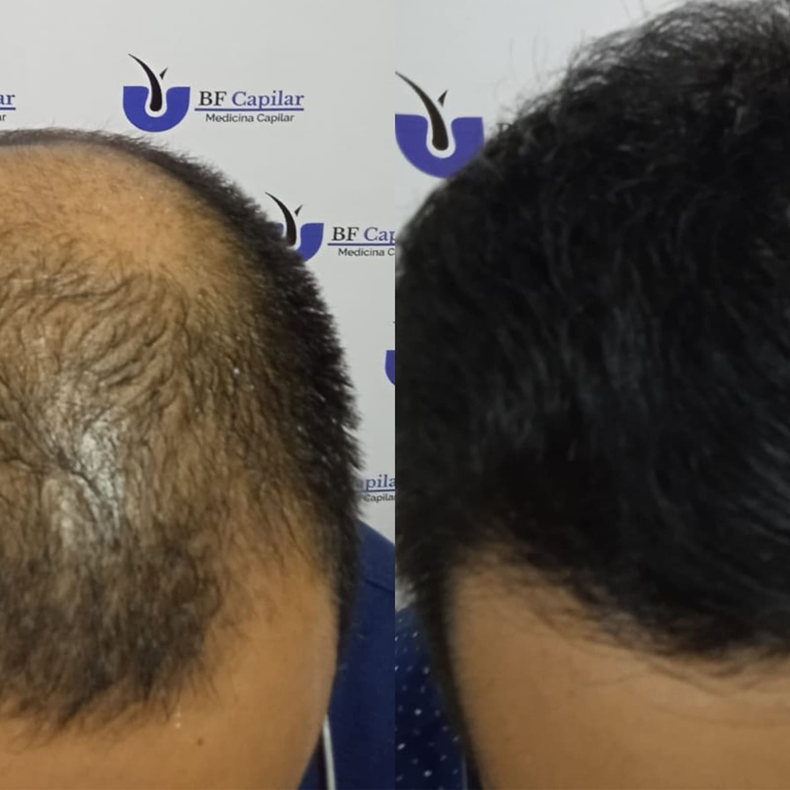 testimonio-de-tratamiendo-para-la-caida-del-cabello